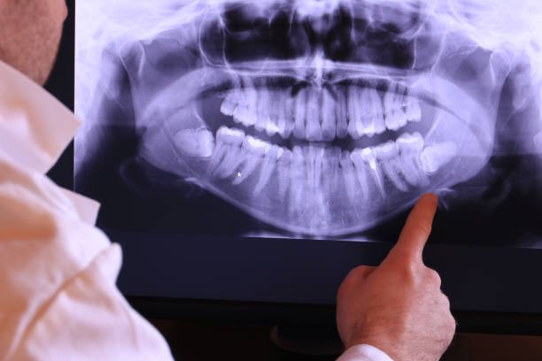Best Walk-In Emergency Dentist in Evans City, PA