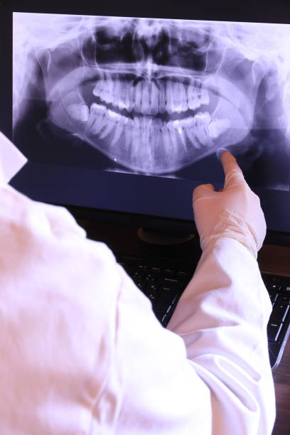 Best Emergency Broken Tooth Repair in Evans City, PA