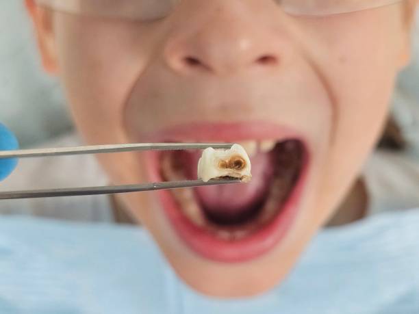 Best Same-Day Emergency Dentist in Evans City, PA