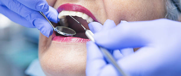 Best Emergency Tooth Extraction in Evans City, PA