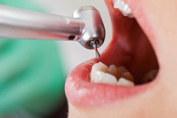 Best Weekend Emergency Dentist in Evans City, PA